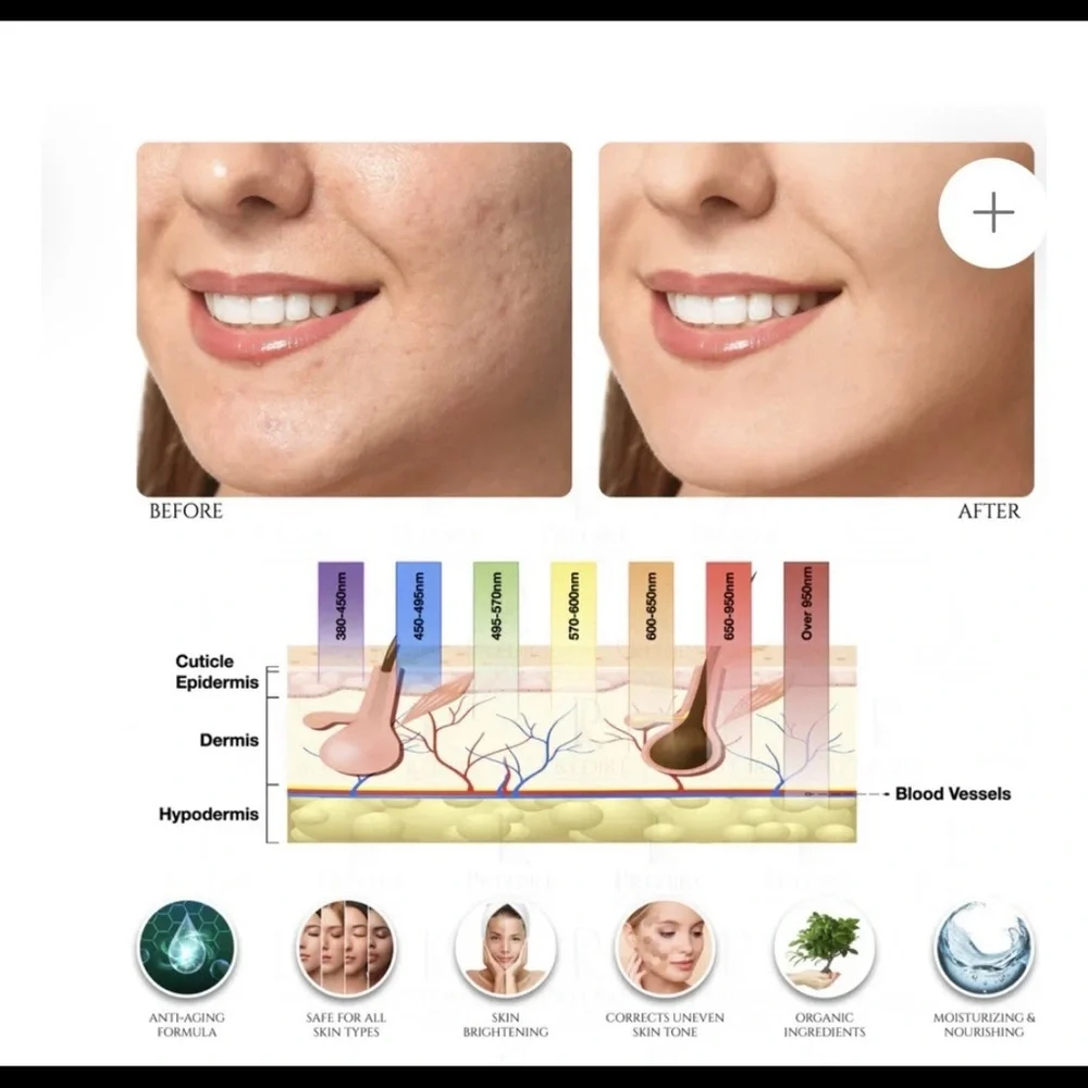 Gold LED Skincare Mask - Picture 6 of 14